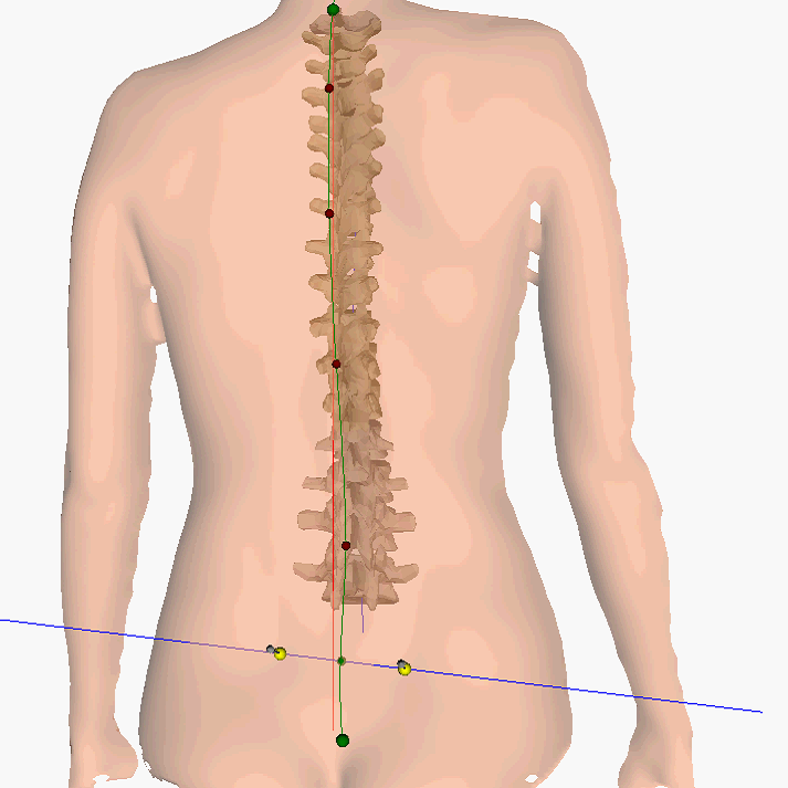 Лечение позвоночника в санатории