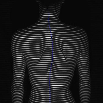 Исследования позвоночника