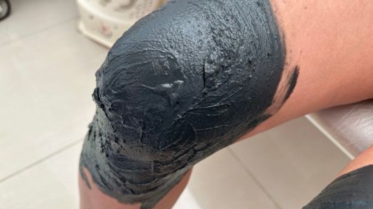 Грязелечение