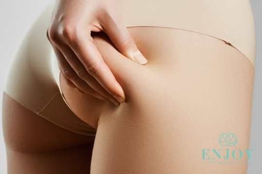 антицеллюлитный массаж москва