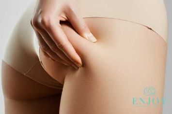 антицеллюлитный массаж