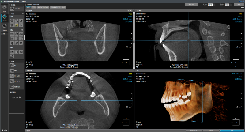 ONDEMAND 3D