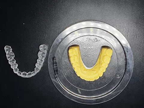 Цифровая зуботехническая лаборатория. Изготовление элайнеров, 3Д печать моделей для термоформовки. Зуботехническая лаборатория, изготовления протезов, коронок, циркониевых коронок, элайнеров и кап