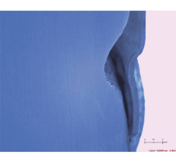 Прямая 3Д печать элайнеров Graphy direct aligners