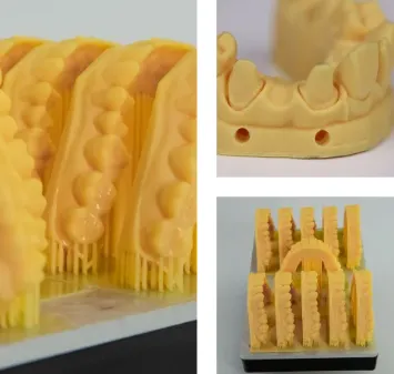 Цифровая зуботехническая лаборатория. 3Д печать стоматологических моделей, временных и постоянных коронок, элайнеров, ложек и хирургических шаблонов. Зуботехническая лаборатория, изготовления протезов, коронок, циркониевых коронок, элайнеров и кап