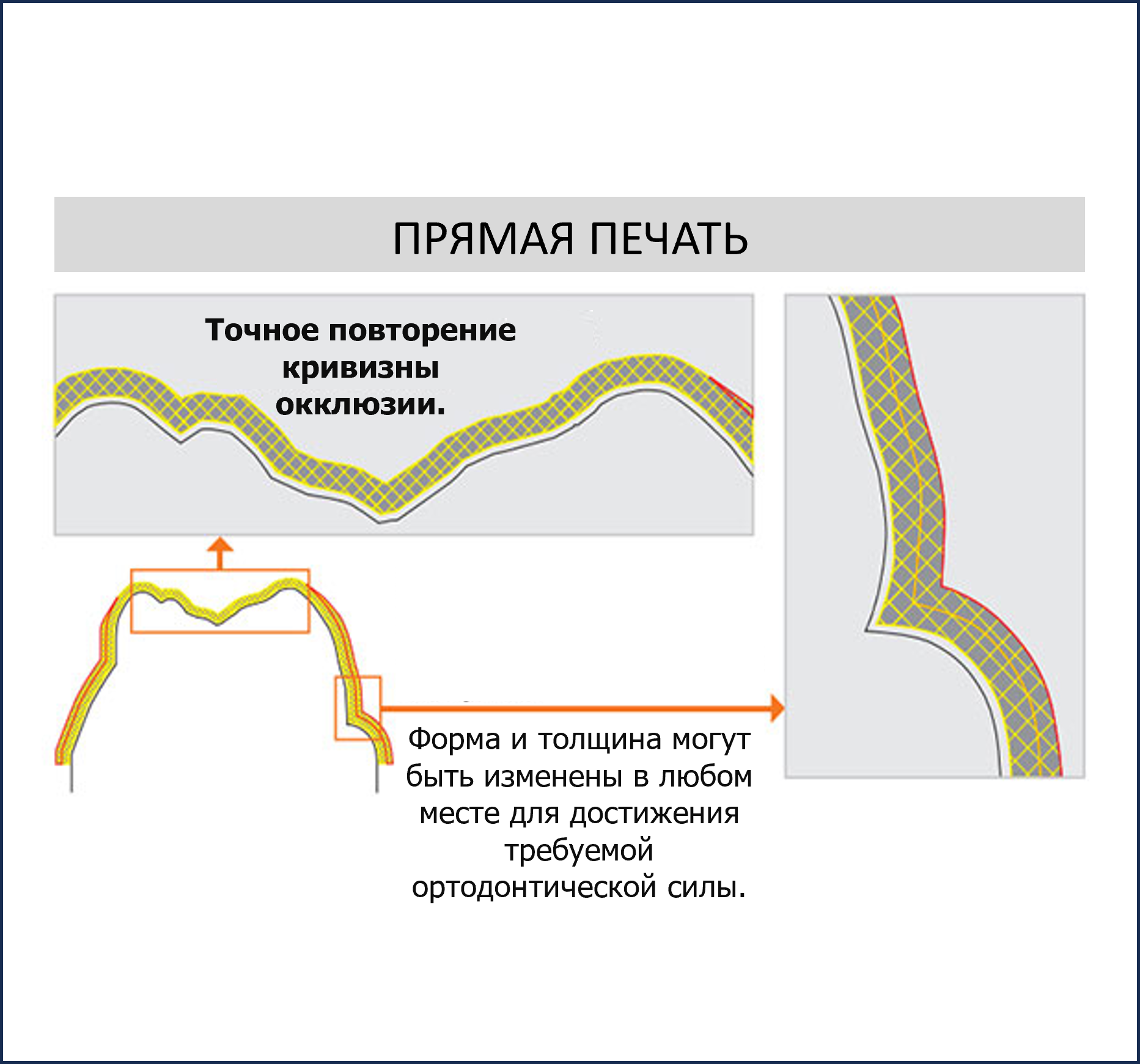 Прямая 3Д печать элайнеров Graphy direct aligners