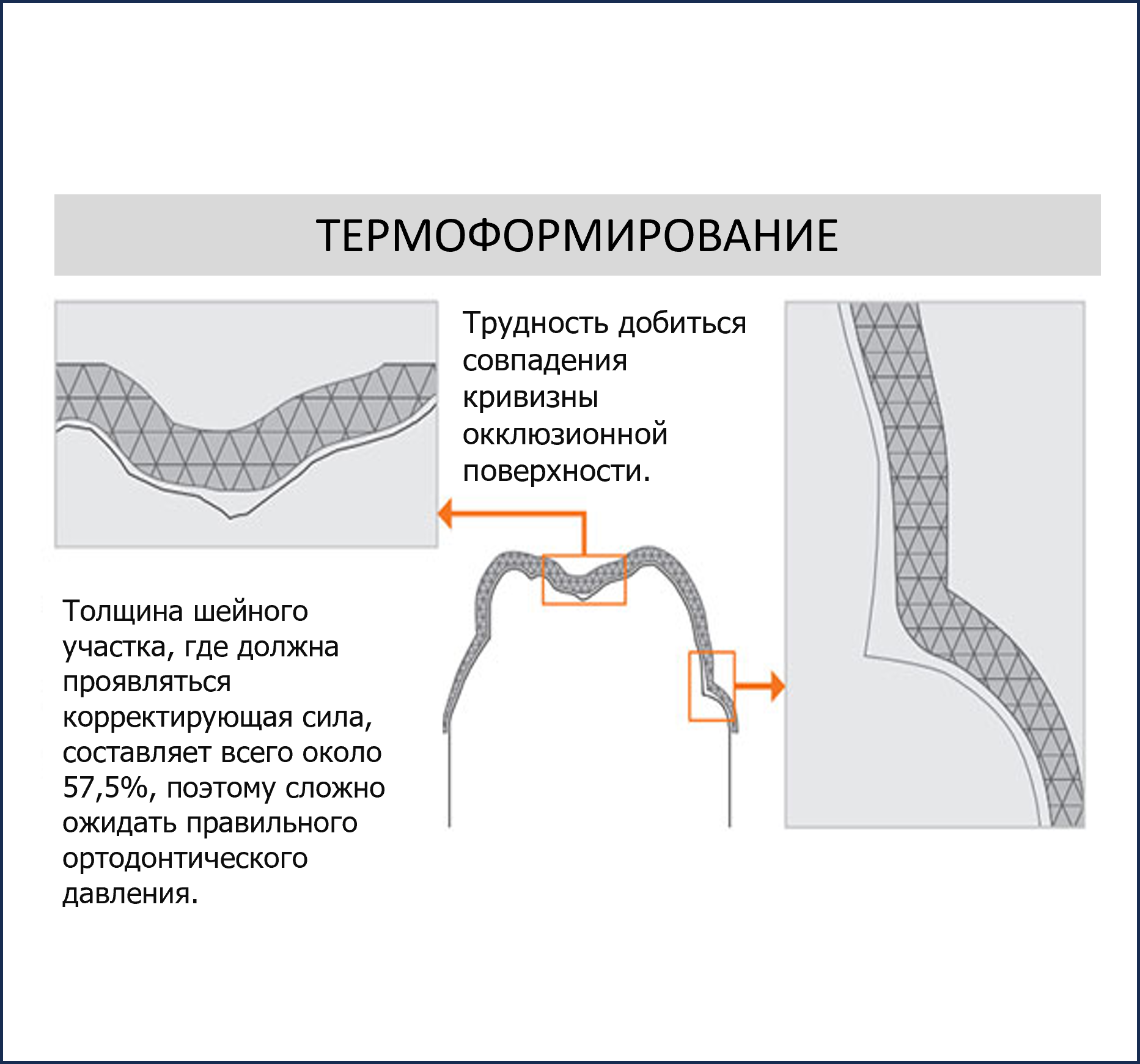 Прямая 3Д печать элайнеров Graphy direct aligners