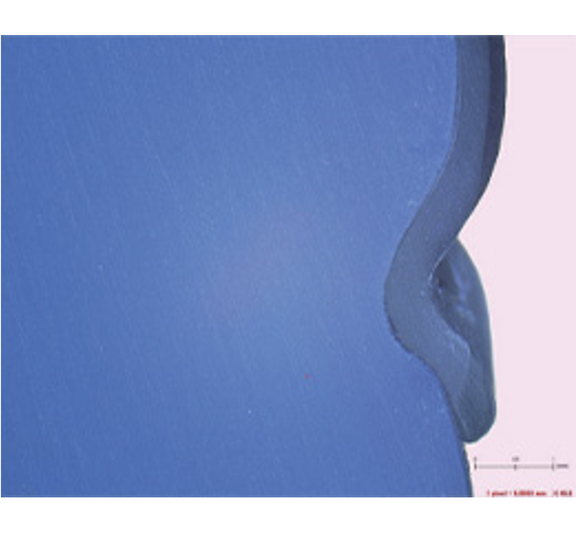 Прямая 3Д печать элайнеров Graphy direct aligners