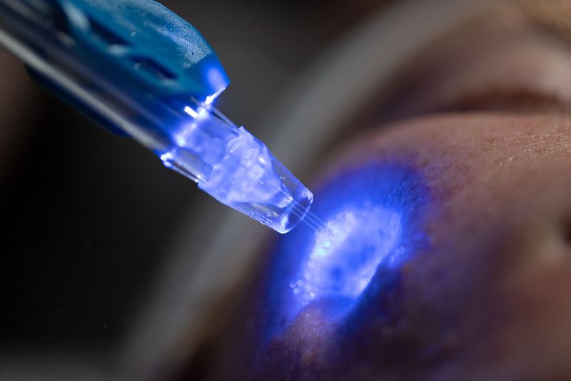 Jet Peel и LED-терапия одновременно