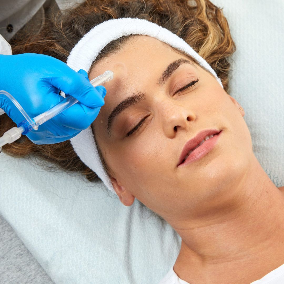 Очищение Jet Peel