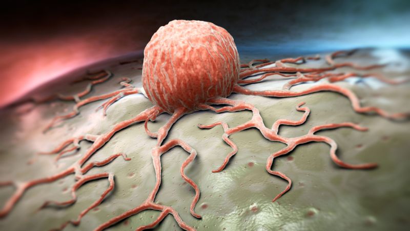 Лечение онкологических заболеваний