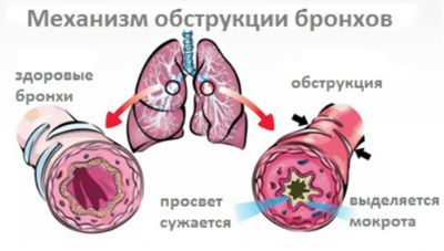 Соляная комната Тюмень